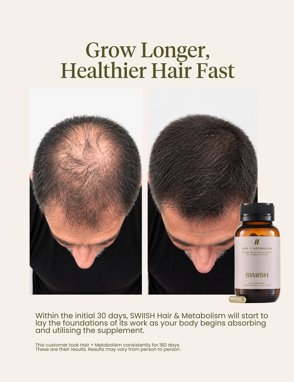 Advertisement for SWISH hair and metabolism supplement showing before and after results.