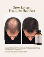 Advertisement for SWISH hair and metabolism supplement showing before and after results.